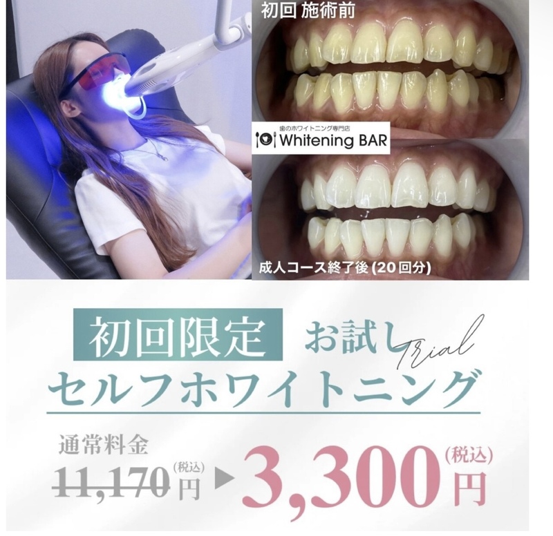 まずはお試し！初めてのホワイトニング✨